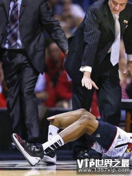保罗乔治断腿是哪一年，2014年(NBA史上最恐怖的3次断腿事故)