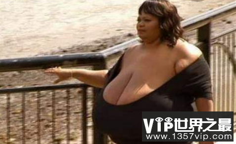 安妮·霍金斯·特纳是世界上最大的天然乳房,身重35.8公斤