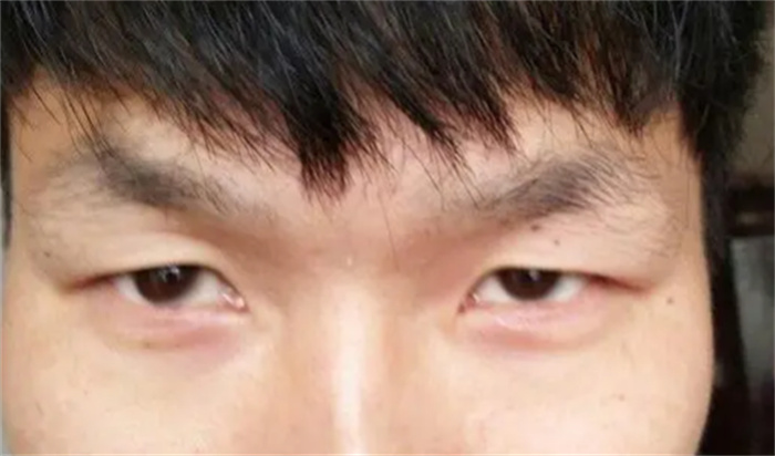 最可怕的男人面相 什么面相的男人会家暴 天庭狭窄