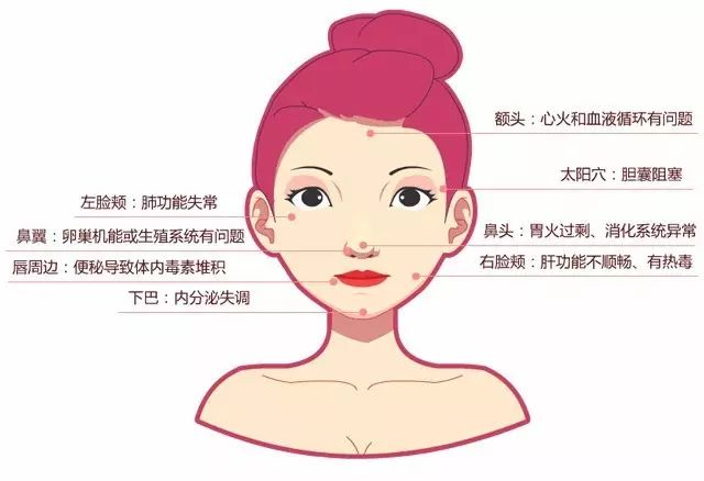 鼻周围频繁长痘是肾虚的外在表现吗？
