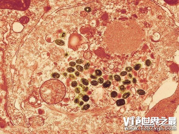 世界十大恐怖病毒，埃博拉仅排第二(第一造成上亿人死亡)
