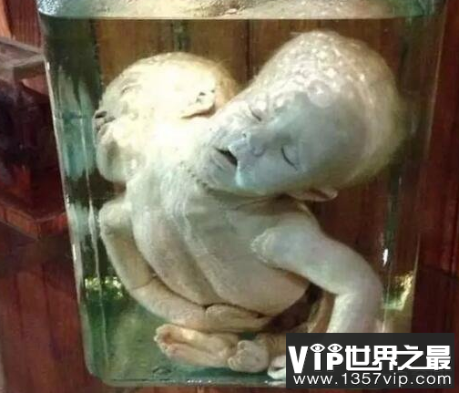马特博物馆是世界上最可怕的博物馆,拥有最不正常的身体