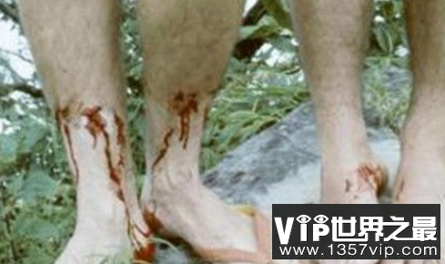 吸血怪物暴君水蛭怎么吸人血的？