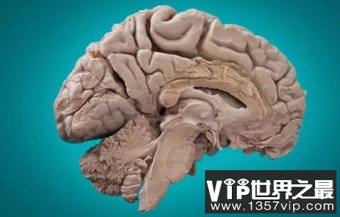 人类智商为什么这么高？