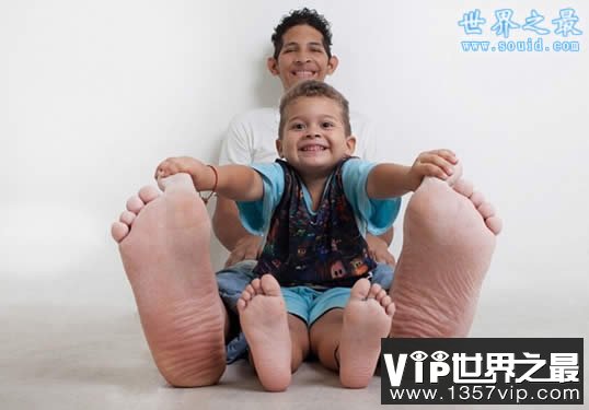 世界上最大的脚，长达0.4米(比小孩还高)(www.1357vip.com)