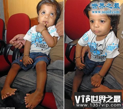 世界上手指脚趾最多的人，印度婴儿14个手指/20脚趾(www.1357vip.com)