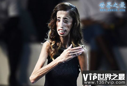 世界上最瘦的女人，像纸人一样(25公斤)(www.1357vip.com)