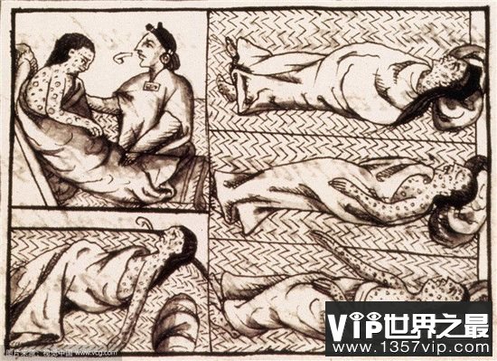 【古代死亡率最高的疾病是哪种】古代的不治之症其实并不可怕