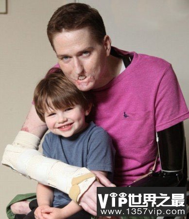 世界上最恶心的人,又丑又恶心的男人和女人(图片)