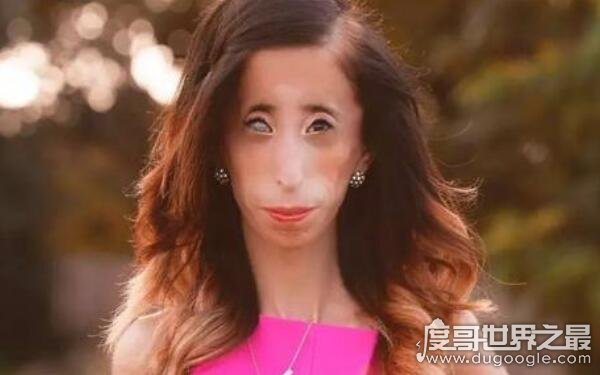 世界上最丑的人唐全书