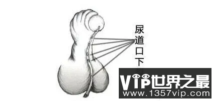 也不是所有弯丁丁都正常