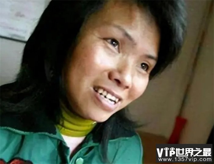 浙江首位男变女，变性人，不听父母劝阻，强行结婚后怎么样了呢？