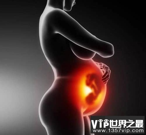 世界怀孕时间最长的人，怀孕了两年时间