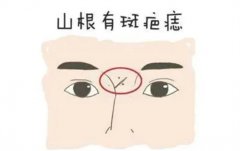 容易遇到渣男的女人面相是怎么样的呢（山根有疤痕）